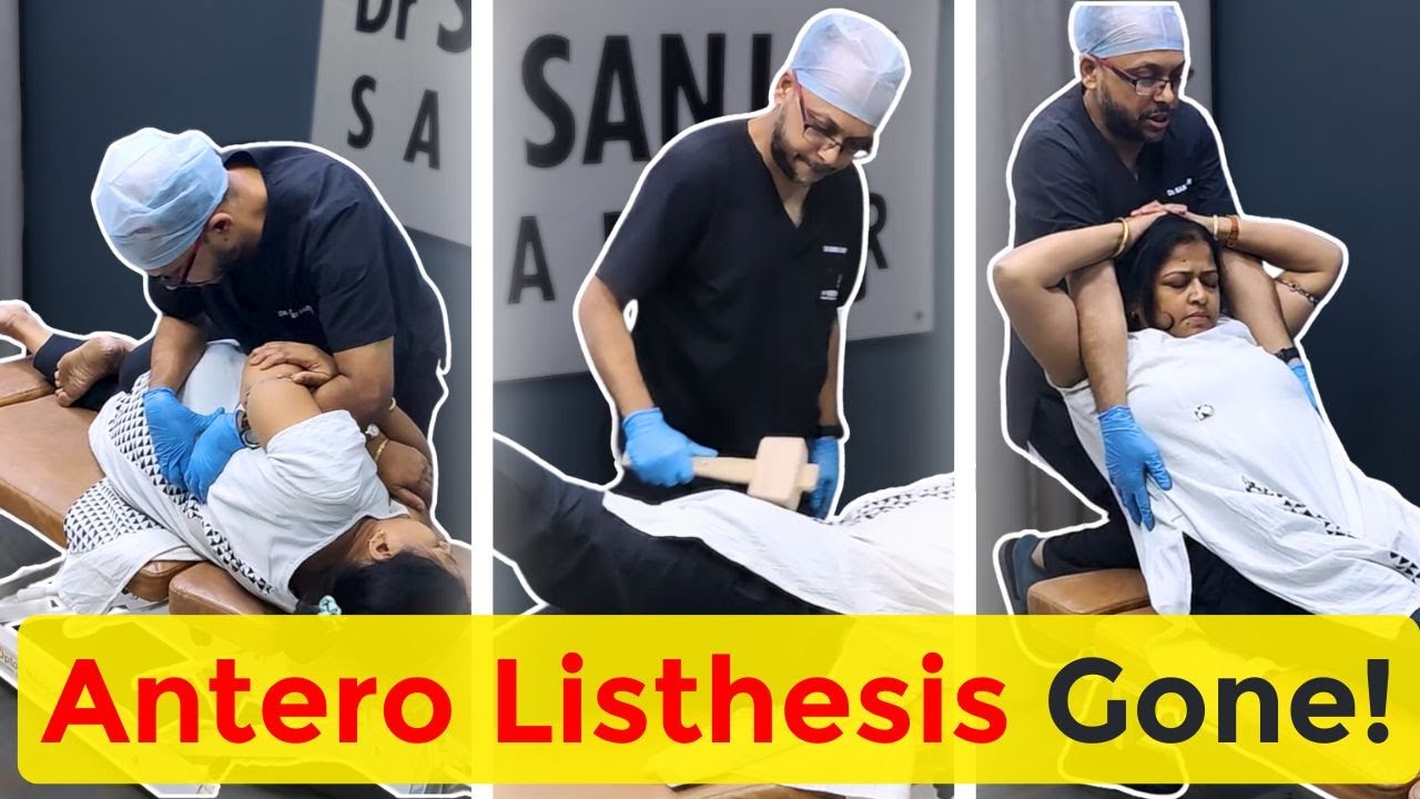 Antero Listhesis কি ঠিক হতে পারে? Chiropractic Adjustment দিয়ে Remedy করার চেষ্টা – দেখুন কী হলো!