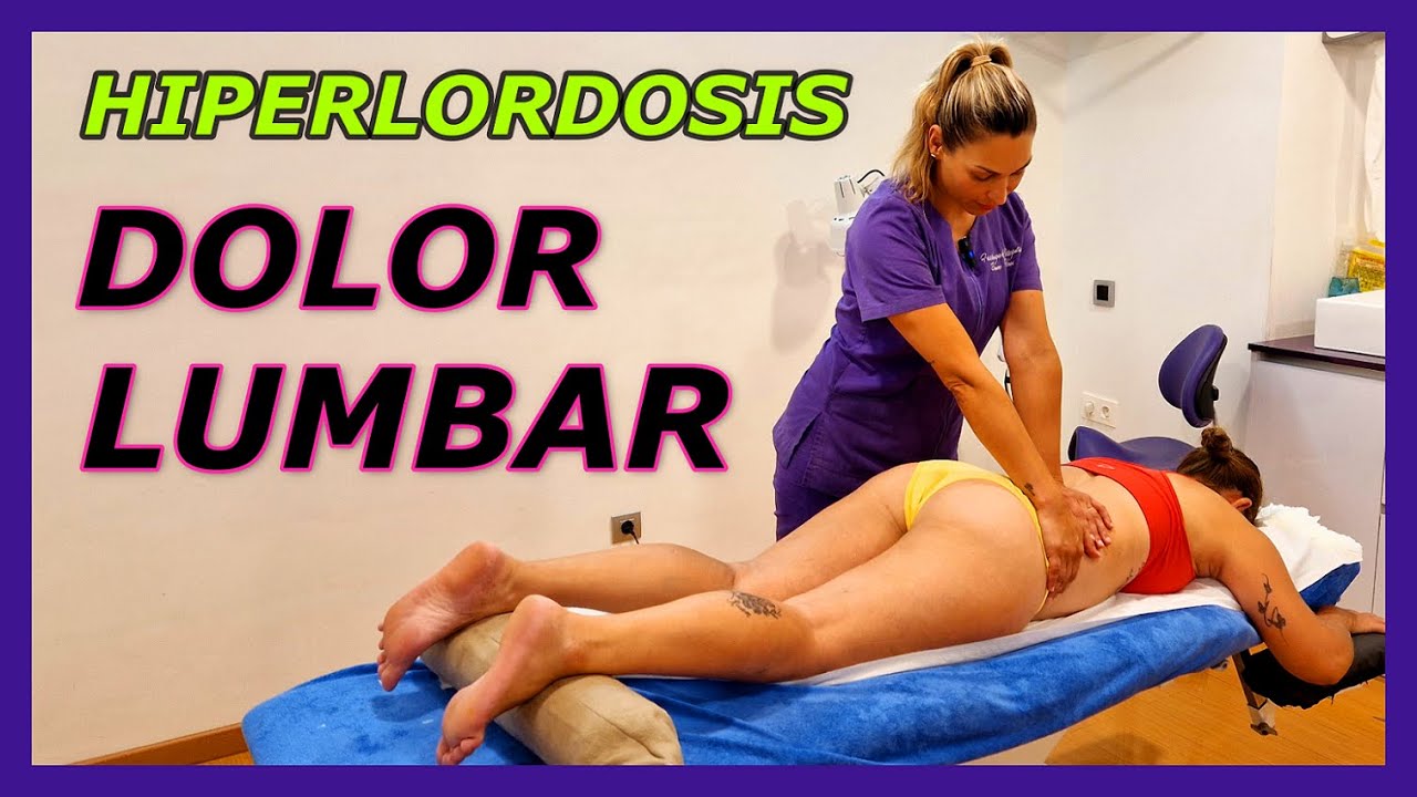 🟣HIPERLORDOSIS LUMBAR/Tratamiento Real🔝 para el dolor lumbar#fisioterapia#osteopatia