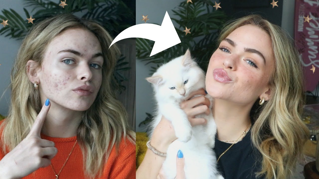 How I’ve been doing my make up for acne lately/life update :)
