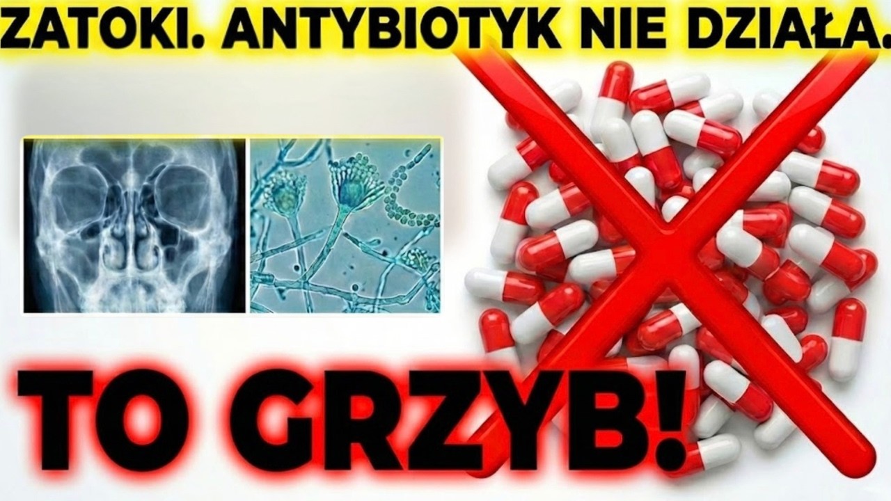 Grzyb w zatokach – Tu antybiotyki nie pomogą! (Co musisz wiedzieć)