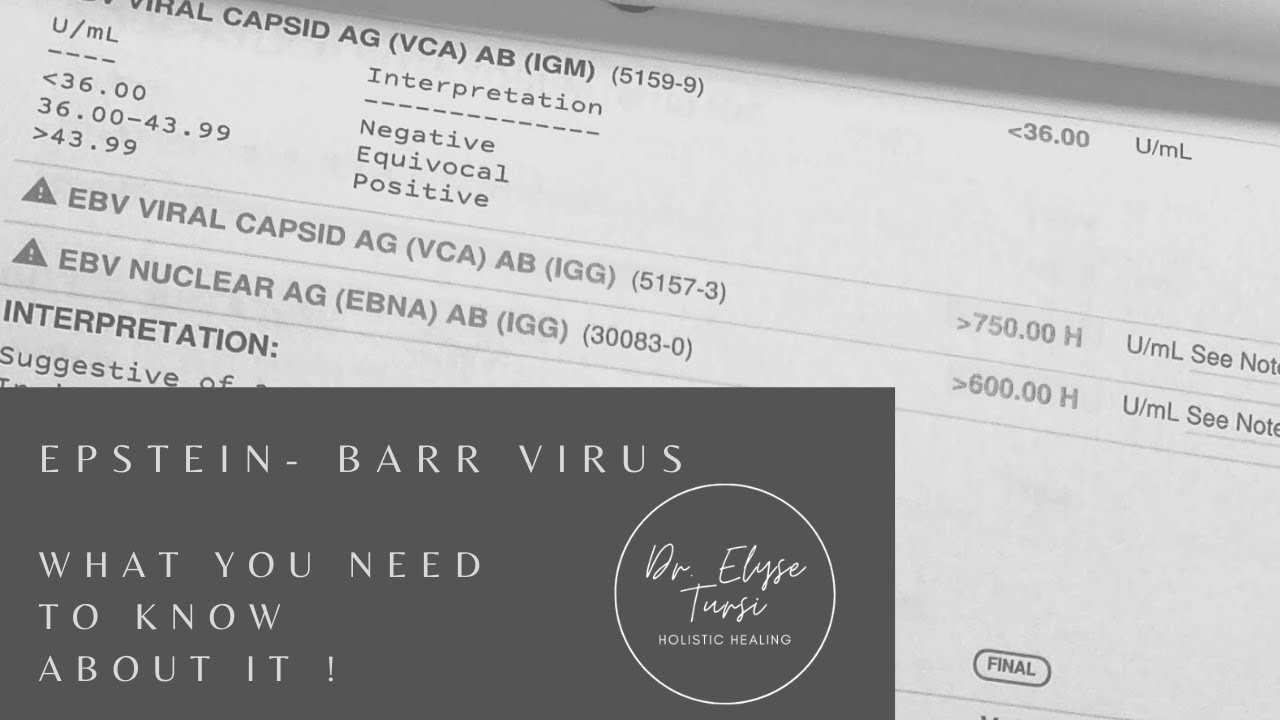 Epstein Barr Virus-What you NEED to know!