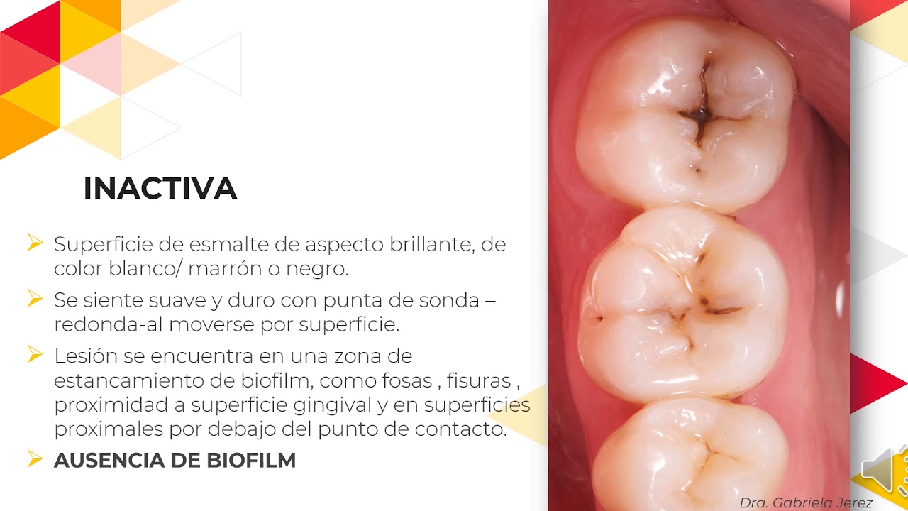 Clase N°7 ODN314 - ICDAS 2020