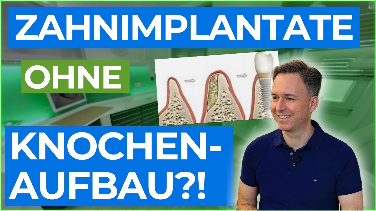 Implantate ohne Knochenaufbau? Ich zeige dir, wie!