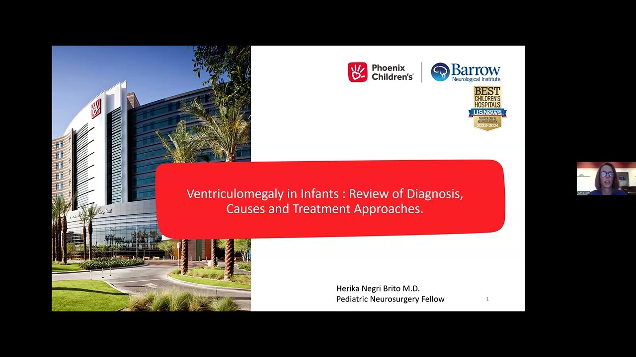 NSGR-Ventriculomegaly in Infants Review of Diagnosis, Causes & Treatment Approaches