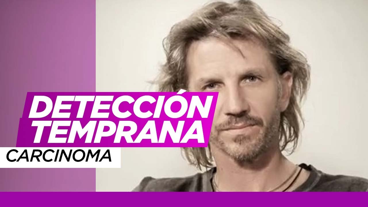 El conmovedor mensaje de Facundo Arana al revelar que tiene lesiones en su piel