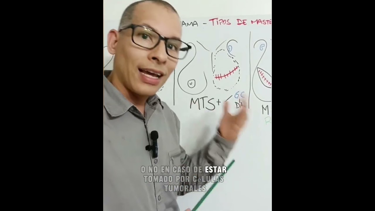 Tipos de mastectom&iacute;as. #mastolog&iacute;a #mastectomia #c&aacute;ncerdemama