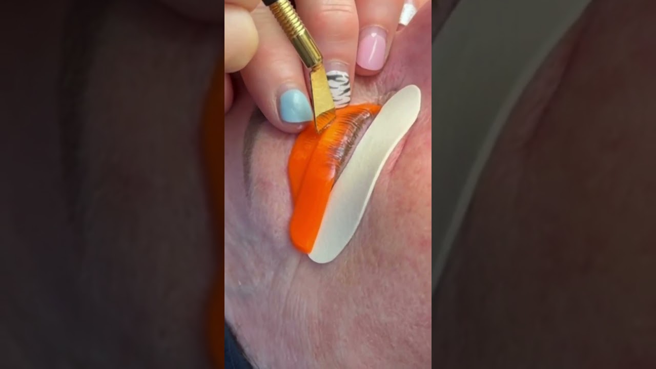 The Precision Lifter Tool has led to a groundbreaking improvement