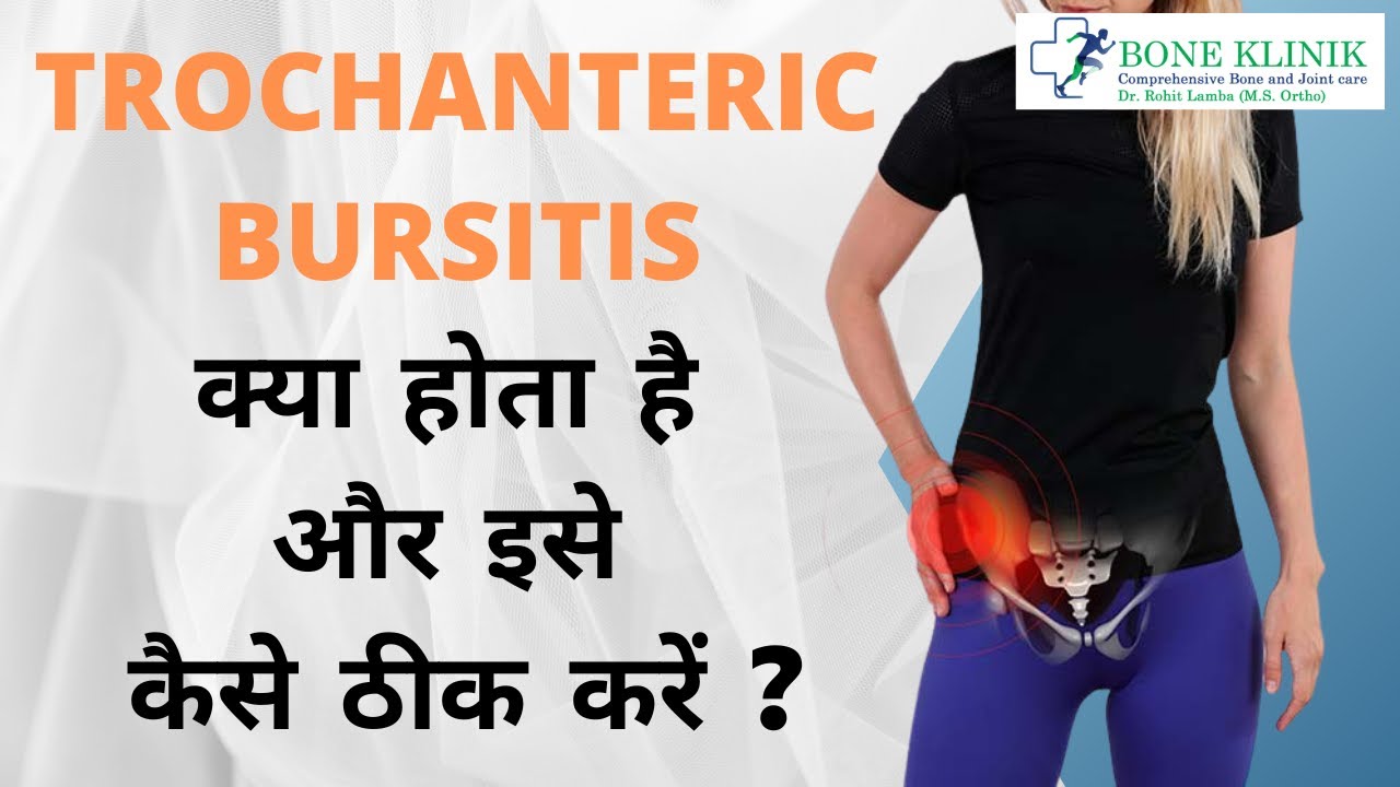 Trochanteric Bursitis क्या होता है और इसे कैसे ठीक करें ? #trochantericbursitis #drrohitlamba
