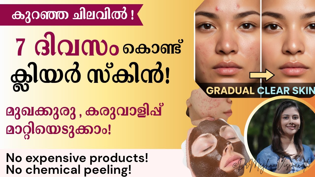 7 ദിവസം കൊണ്ട് ക്ലിയർ സ്കിൻ| മുഖക്കുരു, കലകൾ മാറ്റിയെടുക്കാം| കുറഞ്ഞ ചിലവിൽ കൂടുതൽ തിളക്കം
