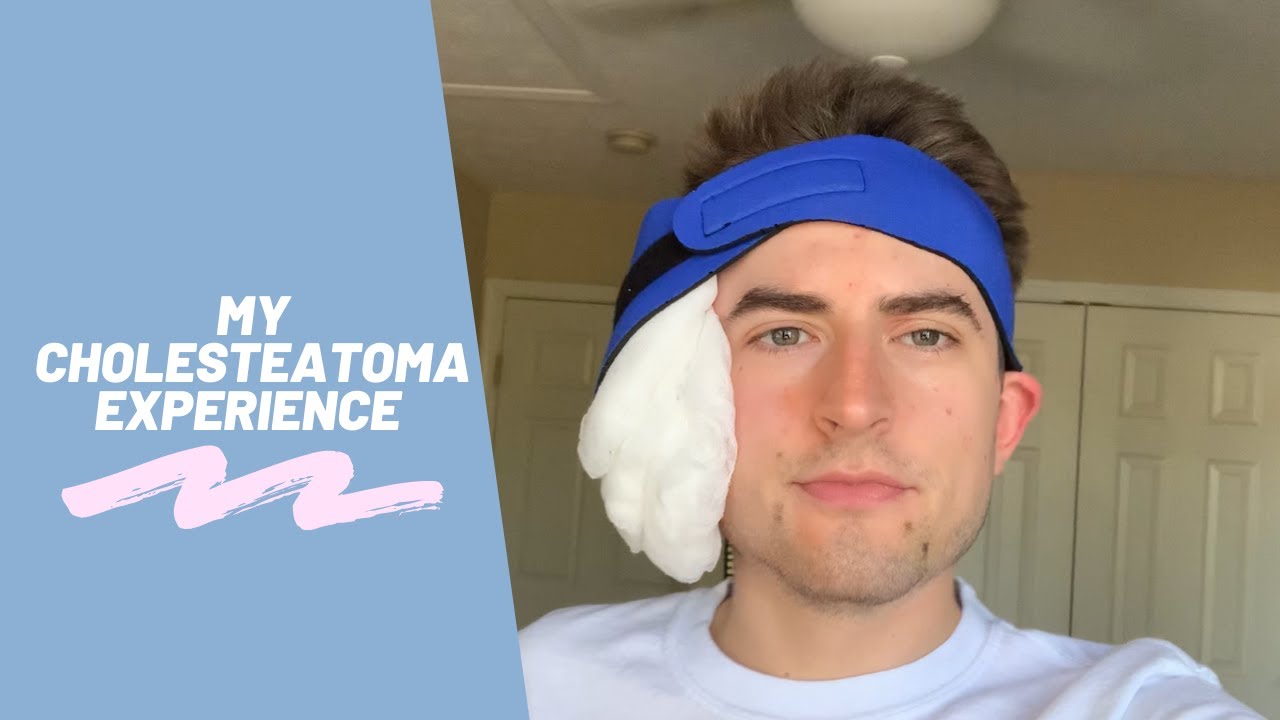 My Cholesteatoma Surgery