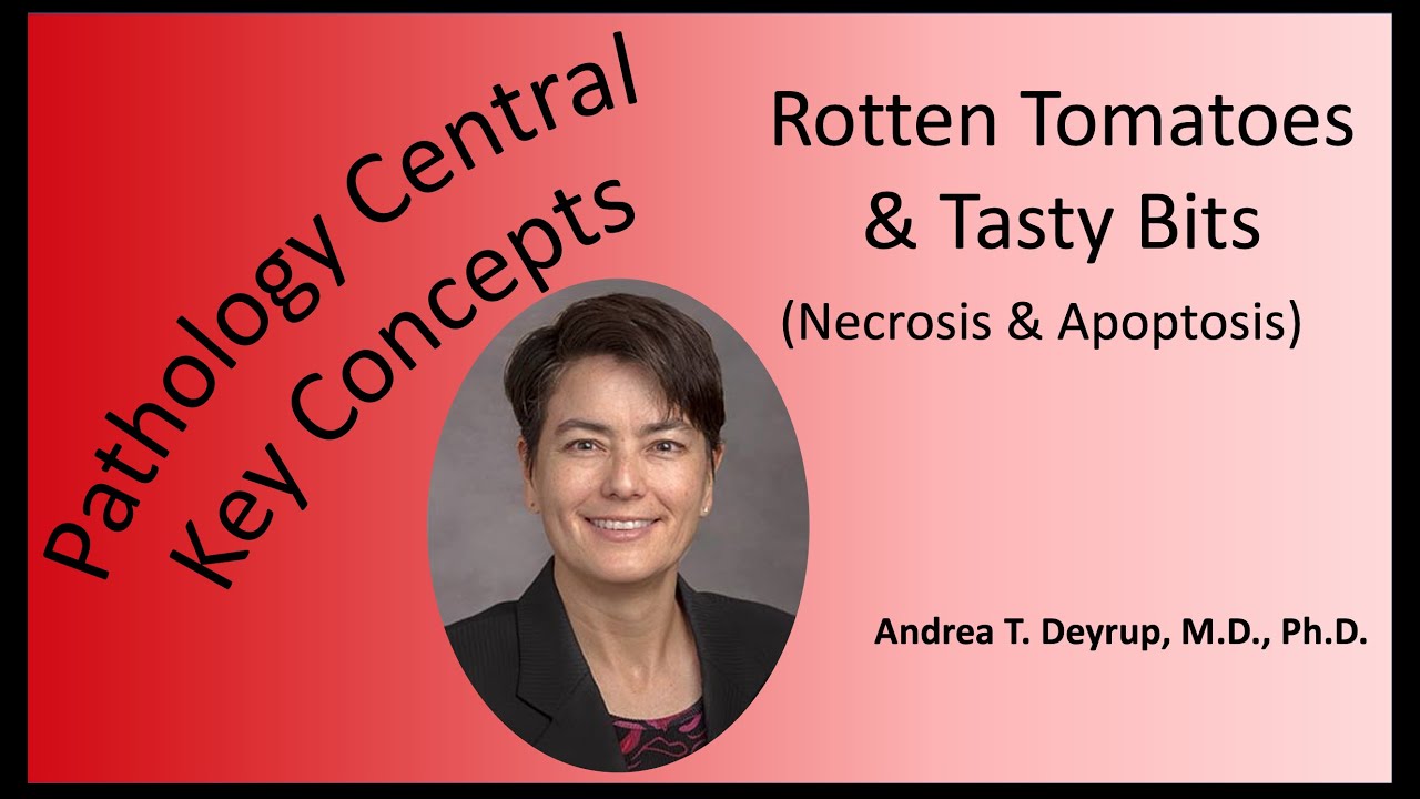 Pathology Central Key Concepts: Rotten Tomatoes & Tasty Bits (Necrosis & Apoptosis)