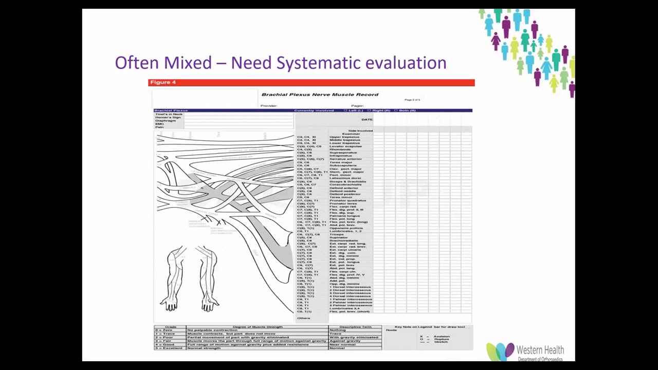 OrthoFracs Adult Traumatic Brachial Plexus Injuries by Dr Dalach O Deasmhunaigh
