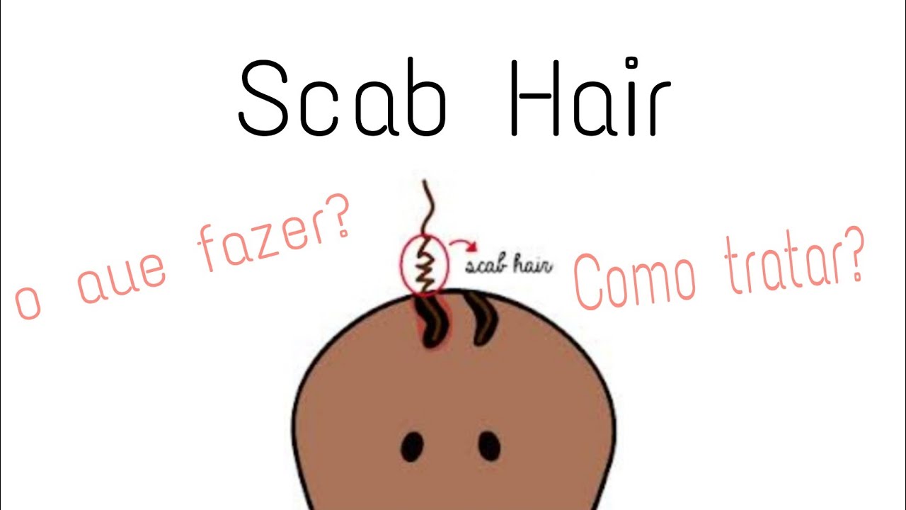Scab Hair, frizz ou cabelo quebrado? | Como tratar o scab hair