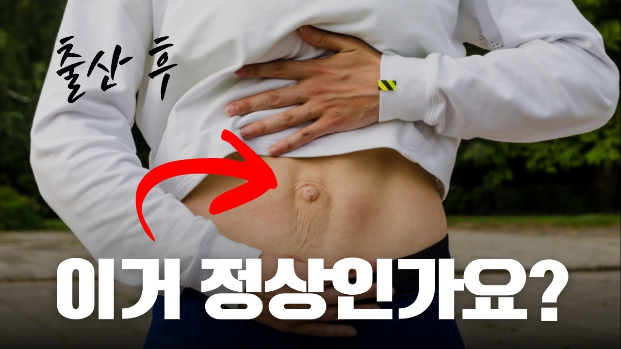 출산 후 배가 안 들어간다면? 복직근 이개 테스트