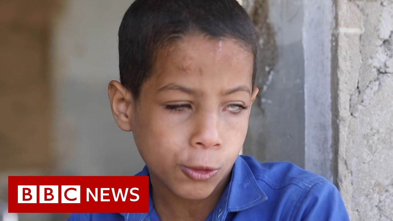 Yemen's blind nine-year-old war-zone school teacher - BBC News