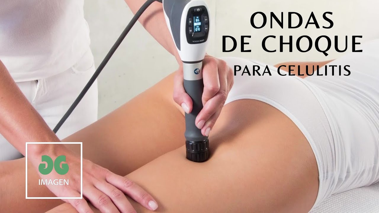 Celulitis: ondas de choque