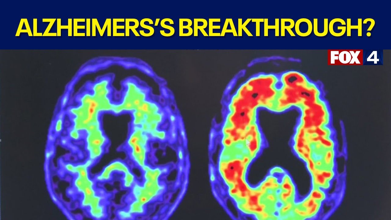 New investigational drug for Alzheimer's disease