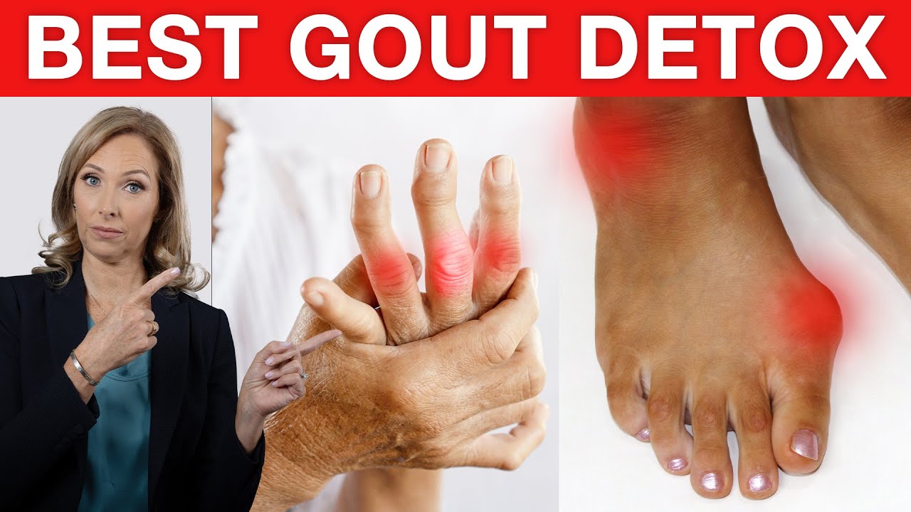 Gout - How to Detox Easily and Quickly | Dr. Janine