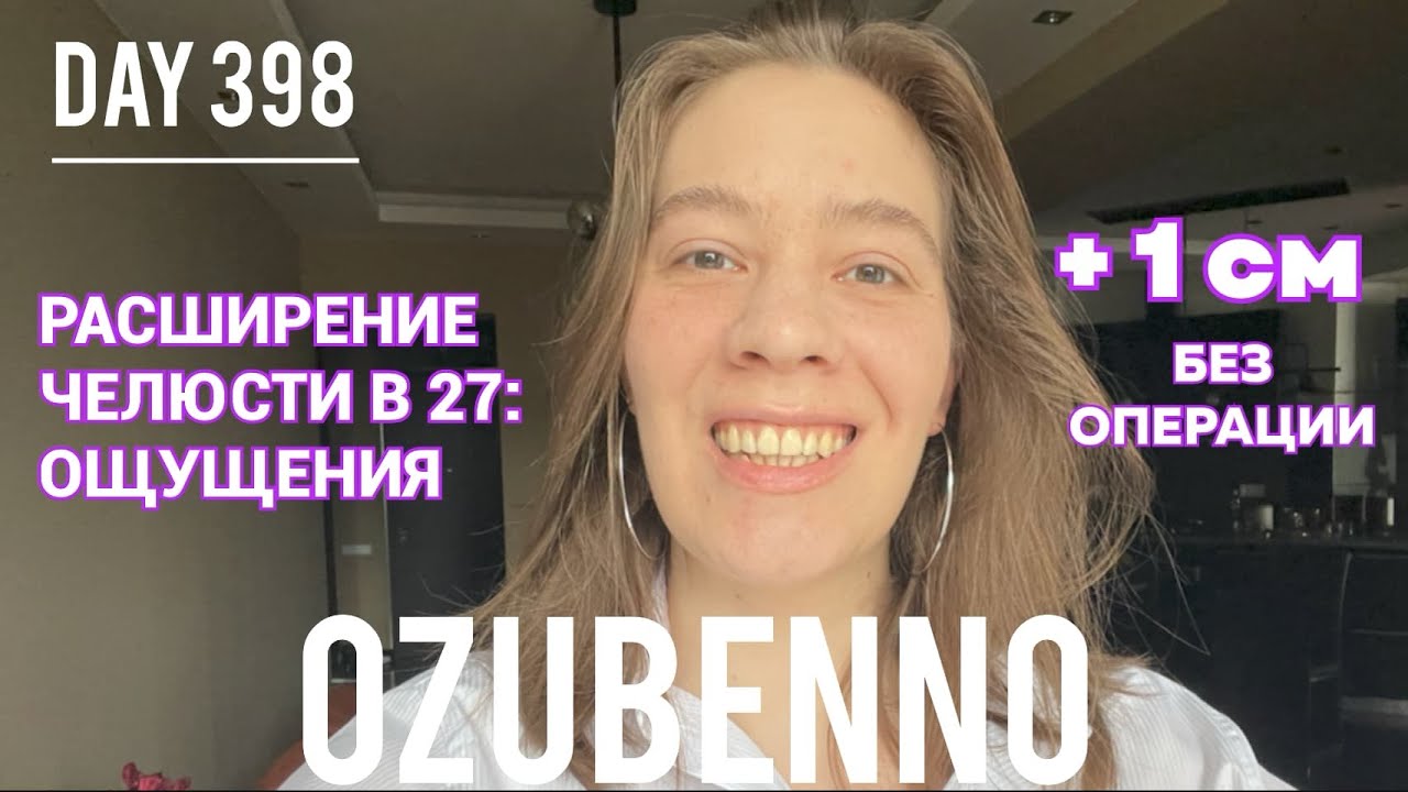 БЕЗ БРЕКЕТОВ день 398: ощущения в начале лечения на аппарате Планас