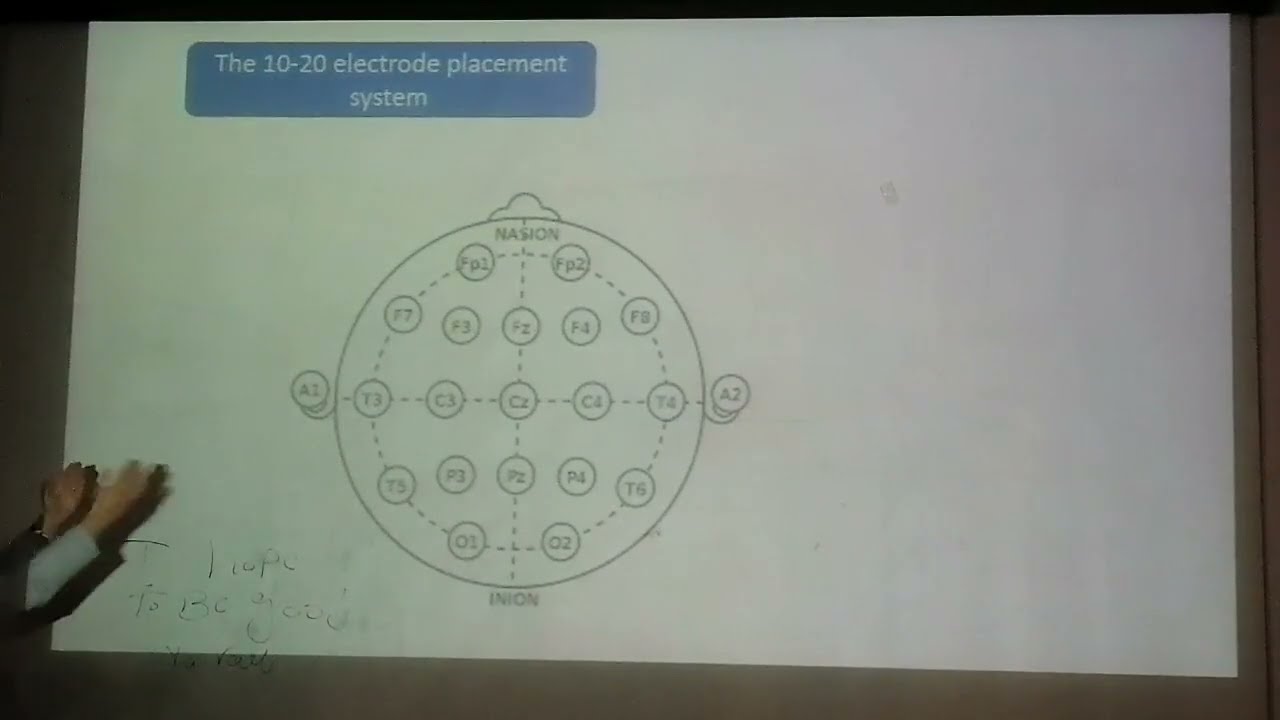 Basics of EEG Prof Marian Yousry