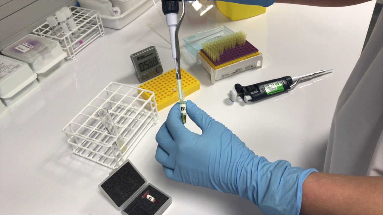 Semen sample processing with SCA (in French)