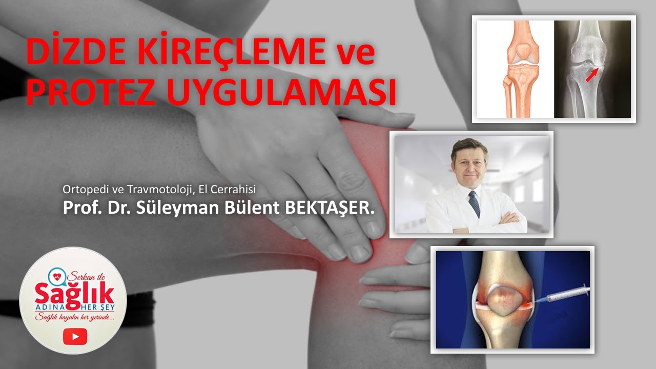 Prof. Dr. Süleyman Bülent BEKTAŞER' ile - Dizde Kireçleme