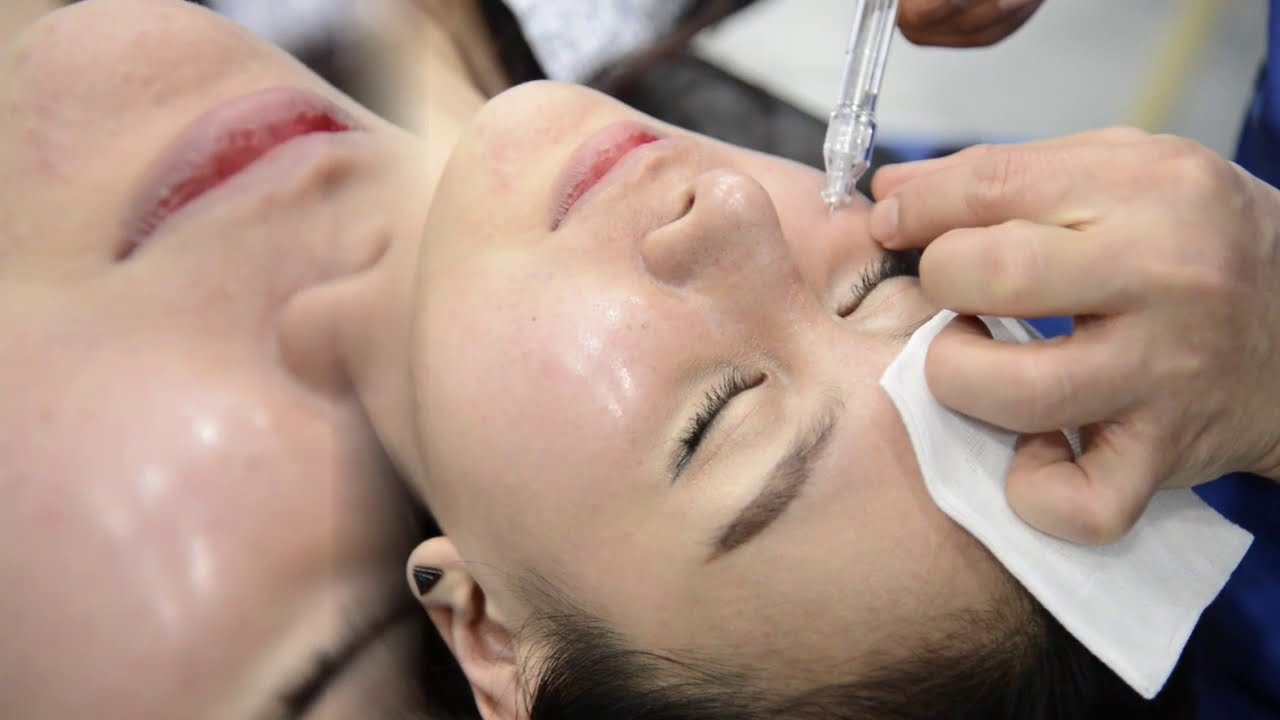 Hyaldew HAFILLER Aplicaci&oacute;n antes y despu&eacute;s