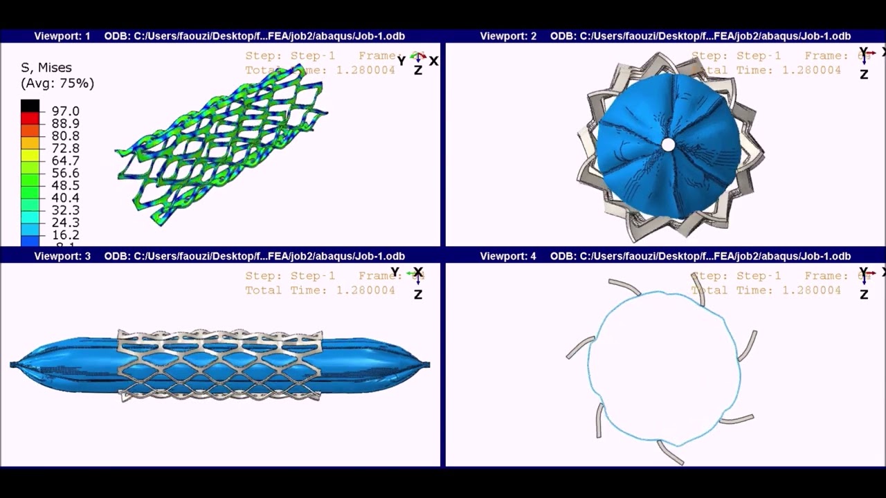 Cardiac stent balloon FEA