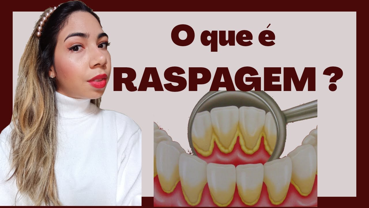 O QUE É RASPAGEM NO DENTISTA?