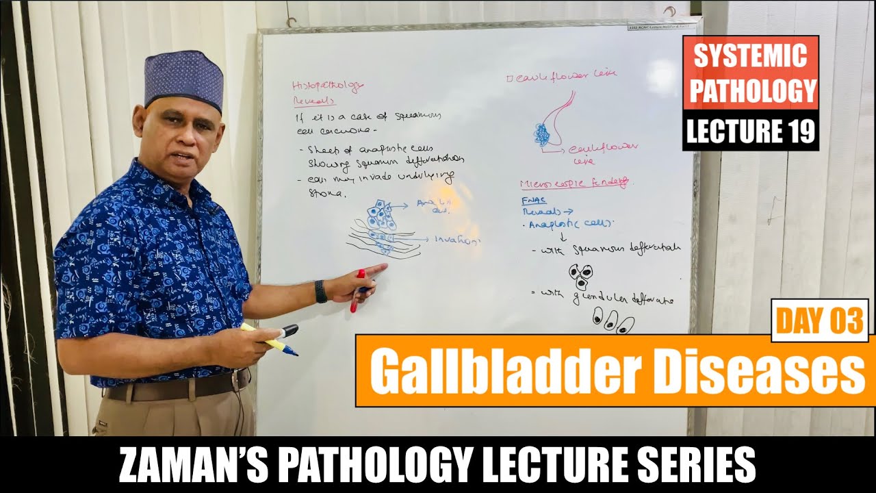 Systemic Pathology: Lecture 19 | Diseases of Gallbladder : Day 03