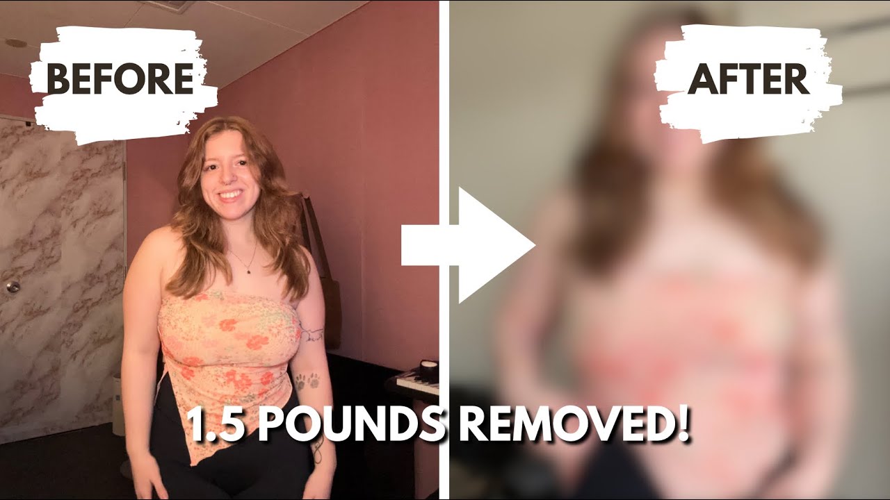 How My Clothes Fit After Breast Reduction | Before & After Try-On