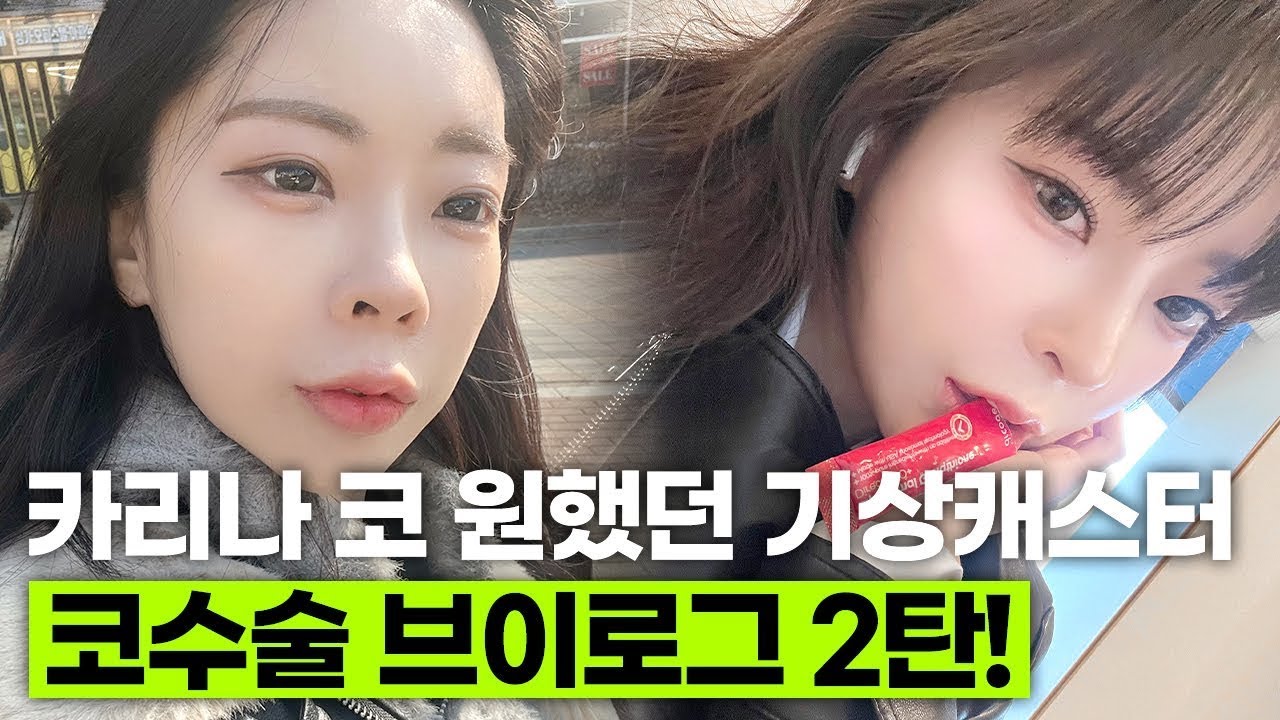 [100% 리얼 코 수술 후기]코 수술하고 카리나 같단 이야기 들었어요 (웃음)^^