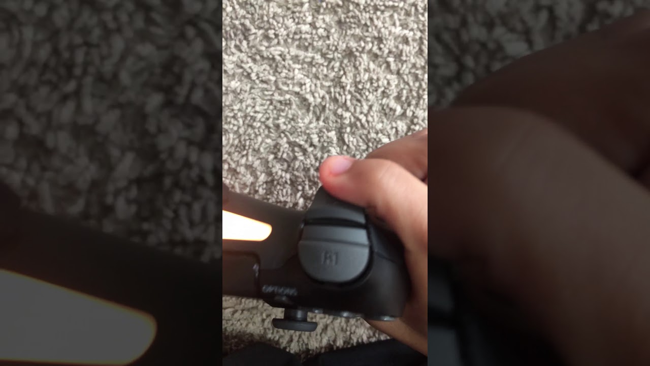 How to pull out teeth in gta 5