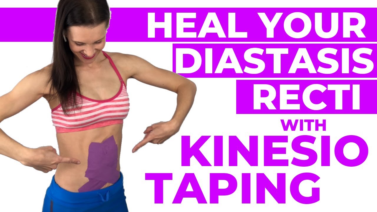 Diastasis Recti Kinesio Taping