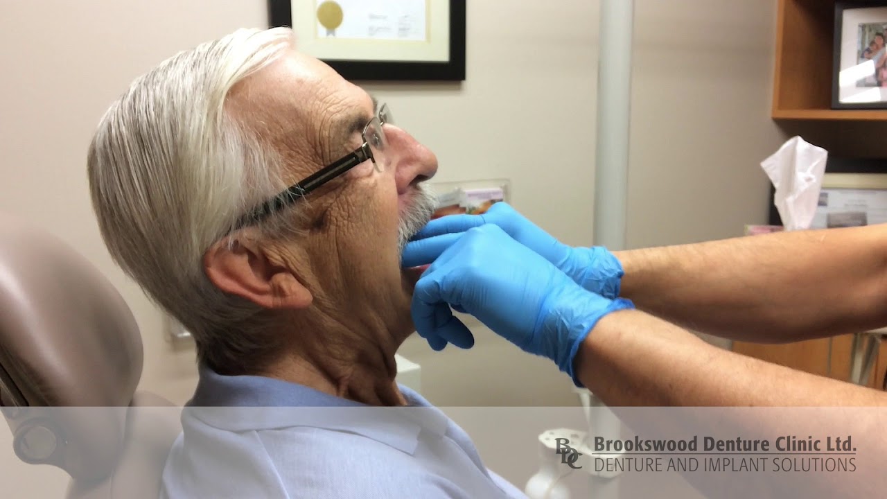 Lower Suction Dentures - No Adhesive, No Implants!