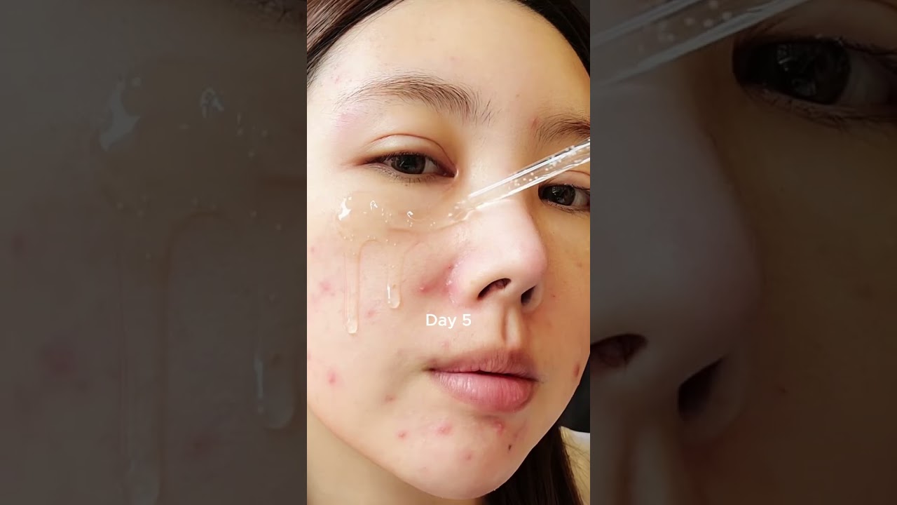 #skin1004