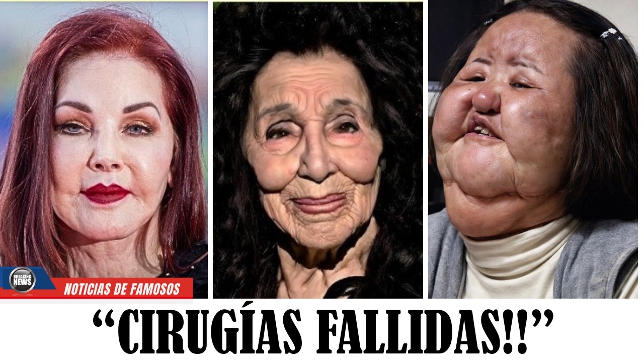10 Famosos que Llevaron la Cirugía Estética Demasiado Lejos