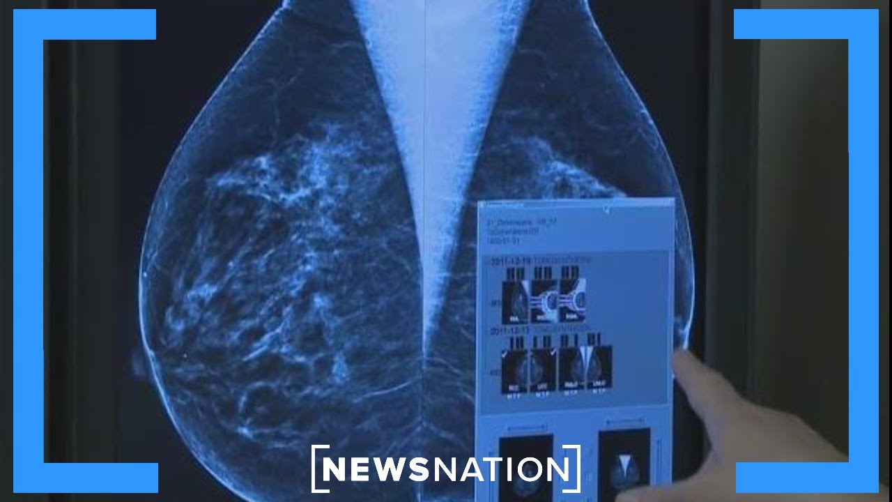 Lifestyle choices lead to breast cancer in younger women: Retired breast surgeon | NewsNation Now