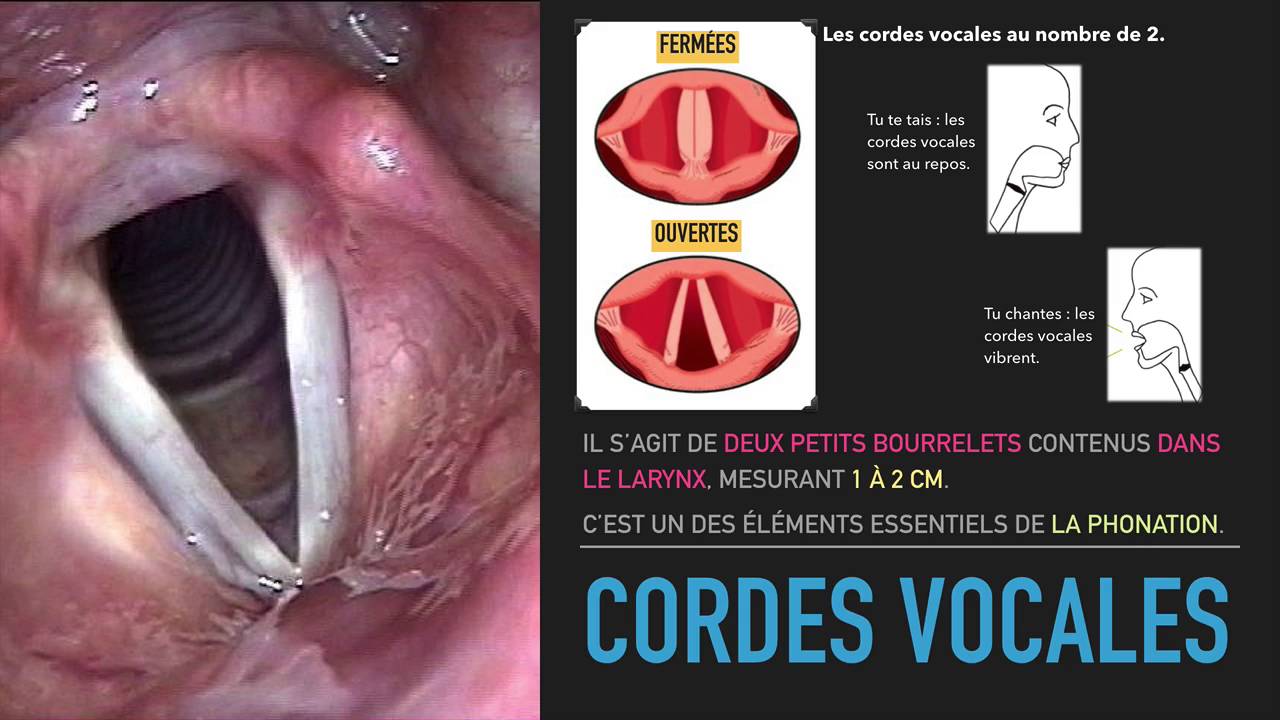 cordes vocales