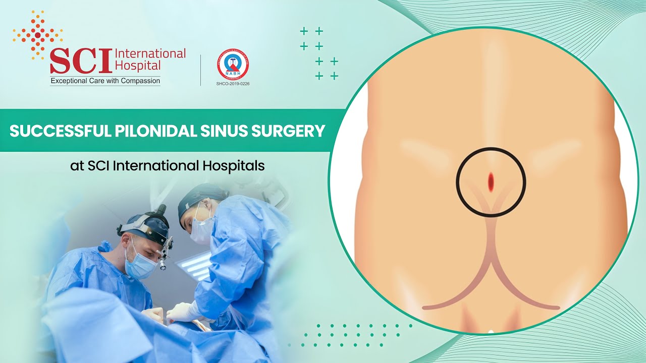 Pilonidal Sinus Surgery: Patient Success Story at SCI International Hospitals