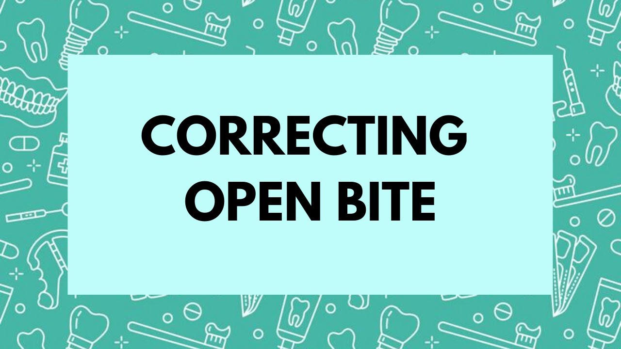 Management of Open bite -Orthodontics