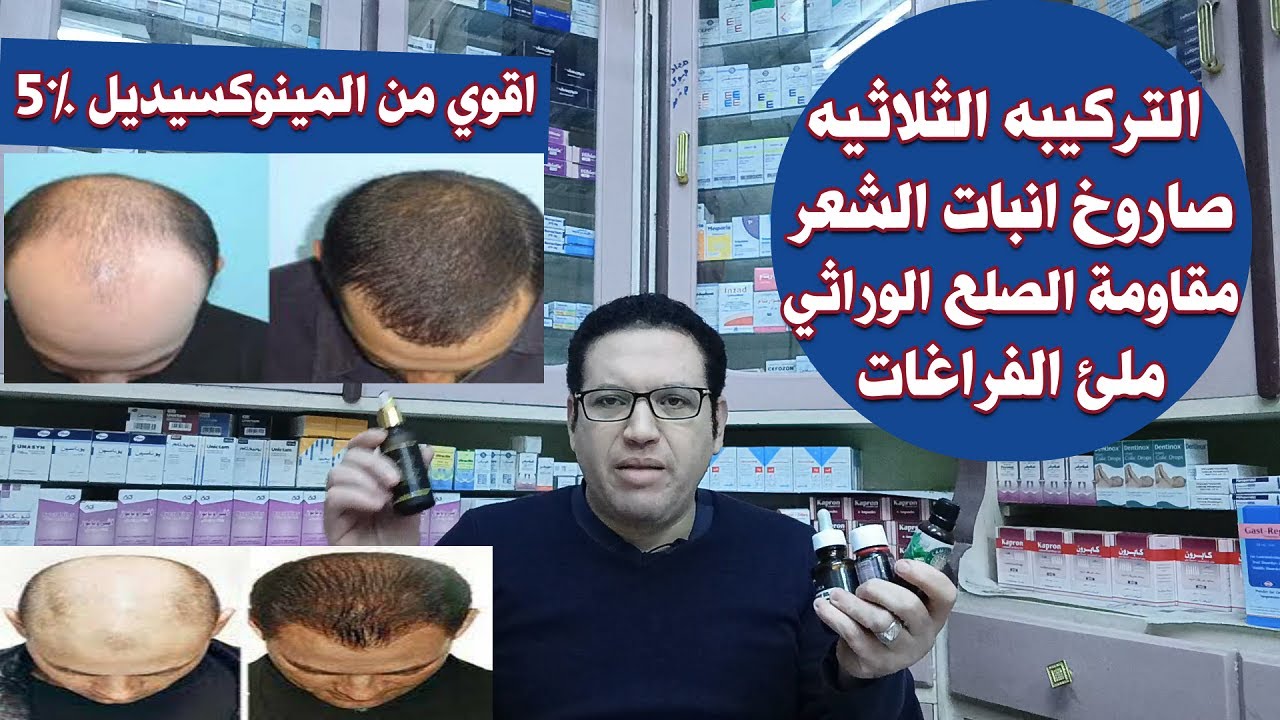 التركيبه الثلاثيه الاقوي علي الاطلاق لعلاج الصلع الوراثي/اعدة انبات الشعر/زيادة كثافته وملئ الفراغات