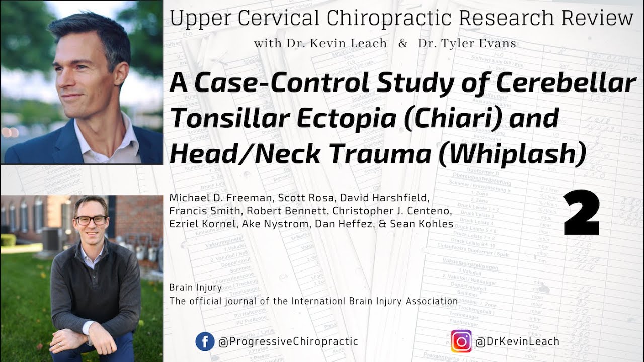 Cerebellar Tonsillar Ectopia (C.T.E.) (Chiari Malformation) and Head/Neck Trauma | Upper Cervical #2