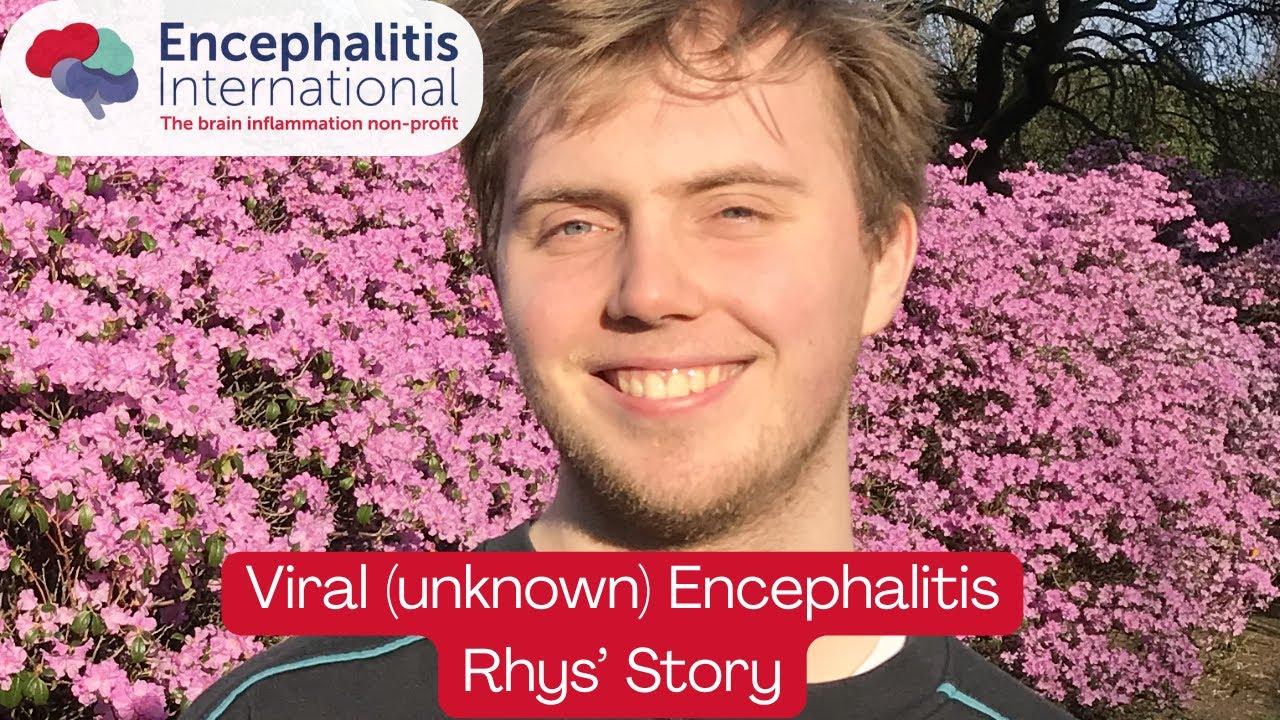 Rhys: Viral Encephalitis Lived Experience ##ViralEncephalitis #Encephalitis