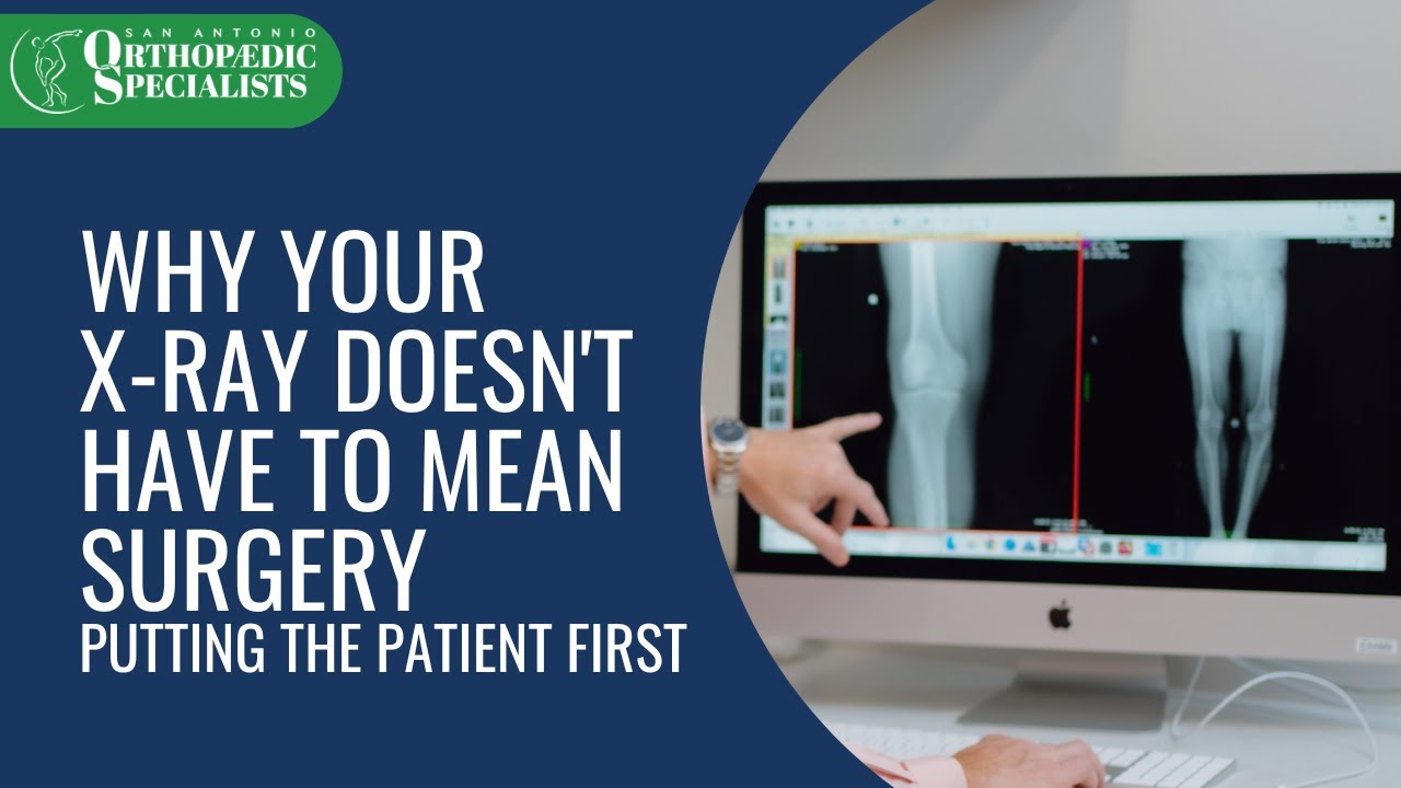 Exploring All Options Before Surgery: Treating the Patient, Not the X-Ray #sanantonio