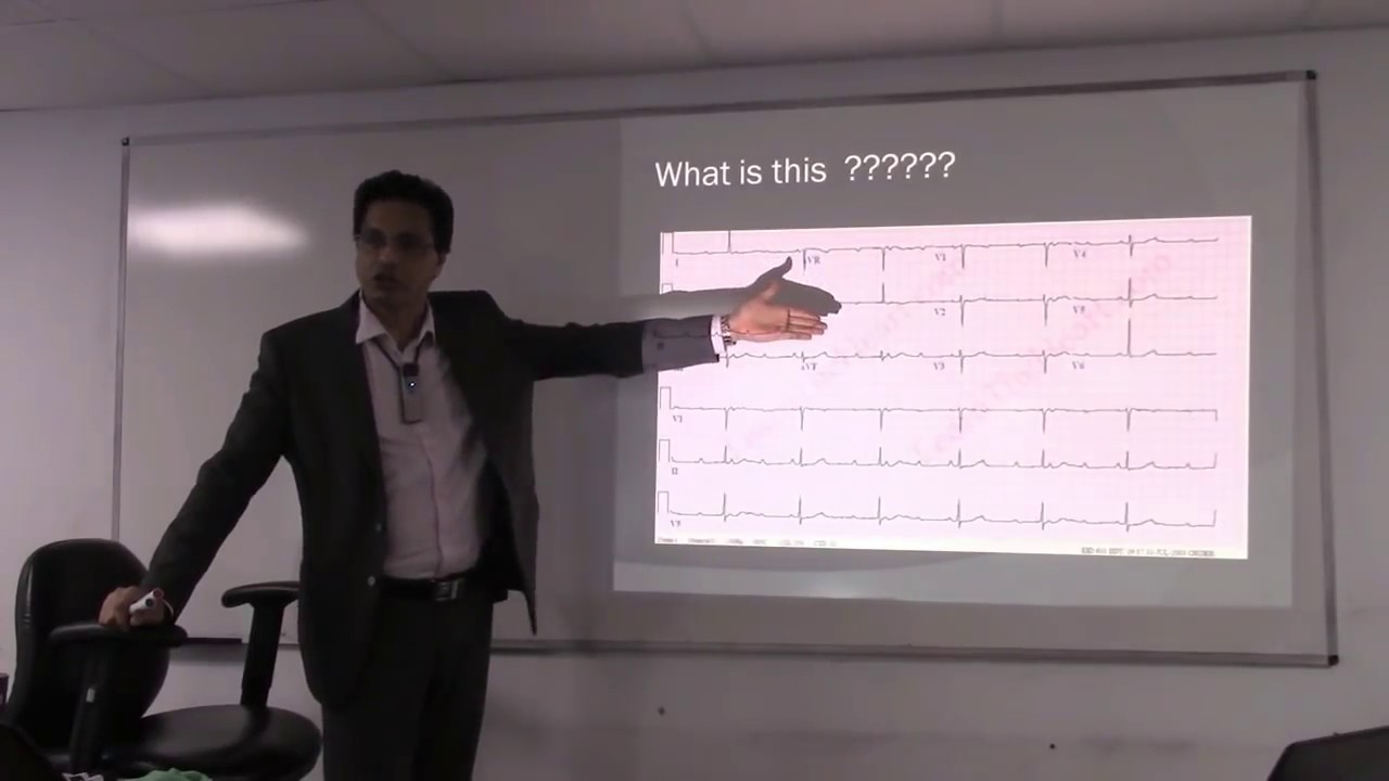 Basic ECG interpretation for the PLAB exam taking doctors By Dr Swamy