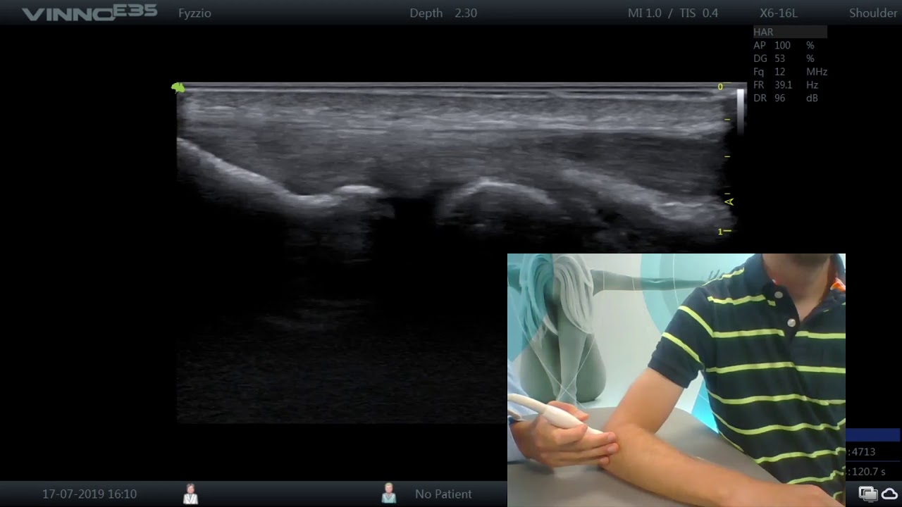 FlyInSonoApp test (pilot) - ultrasound of the lateral elbow