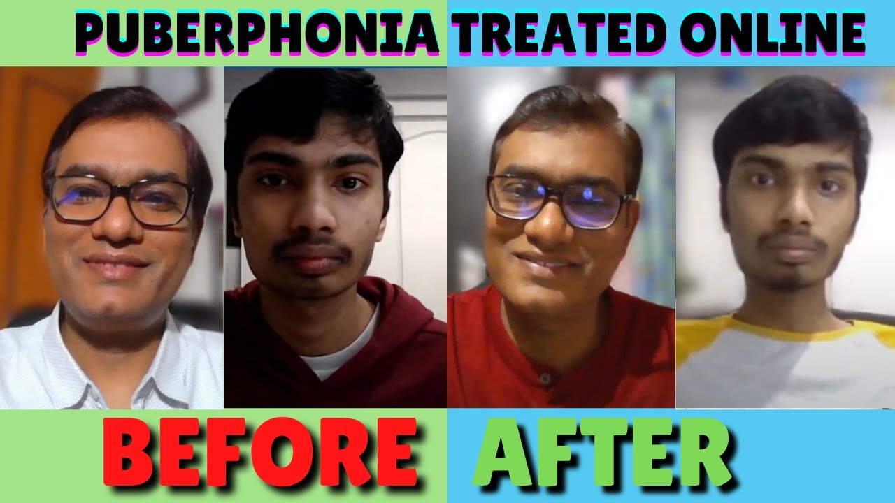 SLP Sanjay Kumar: Pre- Post Puberphonia Online Voice Therapy | Voice Doctor India | Since 2010