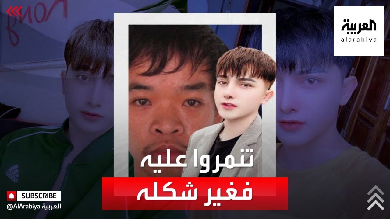 رجل أجرى 9 عمليات تجميل.. لن تتخيل التغيير!