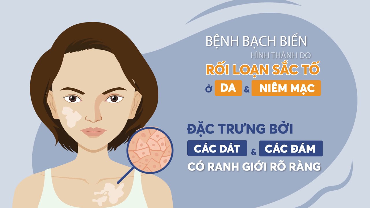 L&agrave;n da bạch biến - Ch&uacute;ng ta c&oacute; quyền đẹp | Pema SkinLab